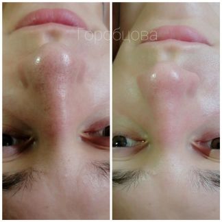 Косметолог-эстетист  Армавир