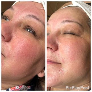 Косметолог  Армавир