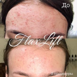 Flaxlift  Армавир