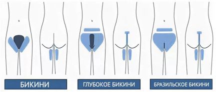 Депиляция  Армавир