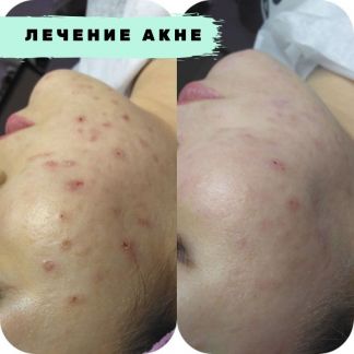 Косметолог-массажист  Армавир