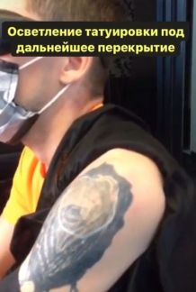 Удаление татуировок и перманентного макияжа  Армавир