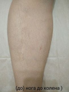 Шугаринг. Севастополь  Армавир