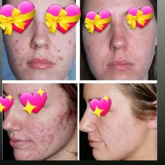 Косметолог чистка лица Диетолог  Армавир