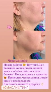 Косметолог  Армавир