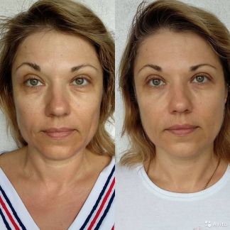 Массаж лица и тела гуаша  Армавир