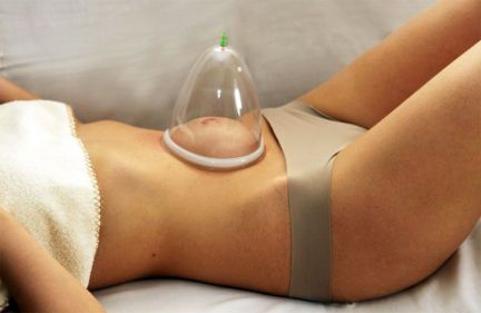 Висцеральный массаж живота. Вакуумные банки  Армавир